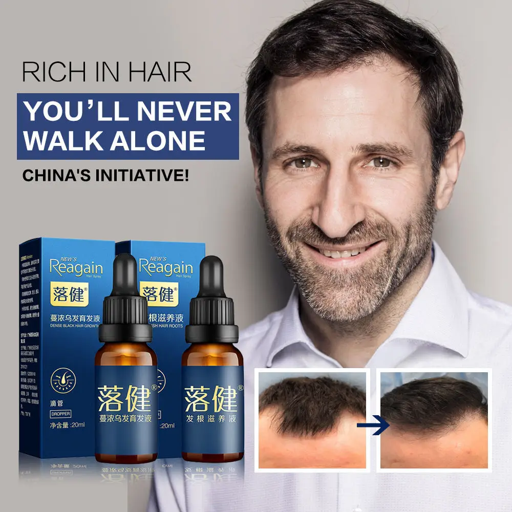 2 шт. сыворотка для роста волос питательный раствор женщин и мужчин