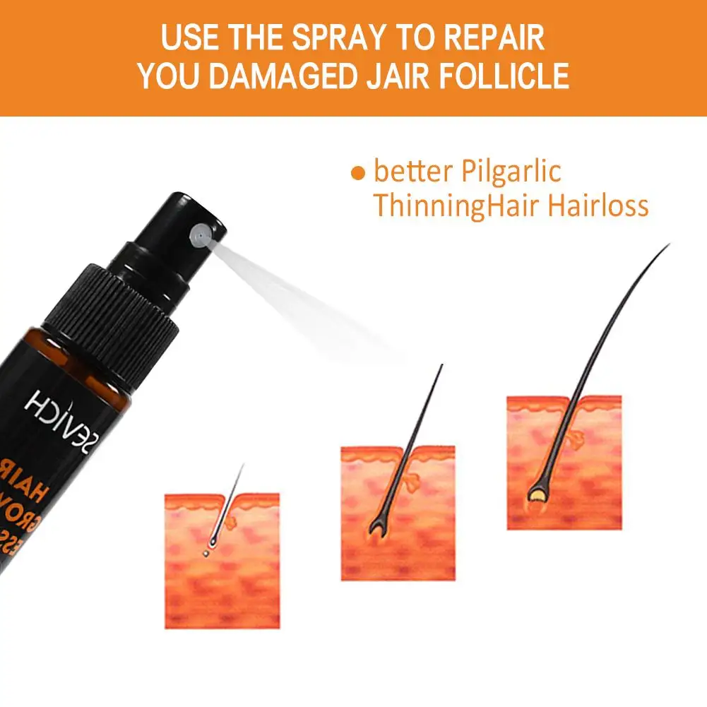 Sevich Hair Growth Spray Serum Products Ginger Anti Loss Fast Regrowth Repair Growing Liquid Scalp Treatment 30ml | Красота и