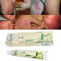 chinese 1pcs zudaifu skin psoriasis cream dermatitis eczematoid eczema ointment treatment psoriasis skin care cream with box