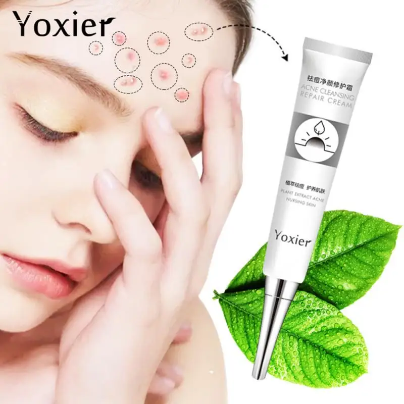 

Acne Treatment Blackhead Acne Dressing Spot Patch Face Cream Skin Care Acne Cream Remove Scar Oil Control Face Care