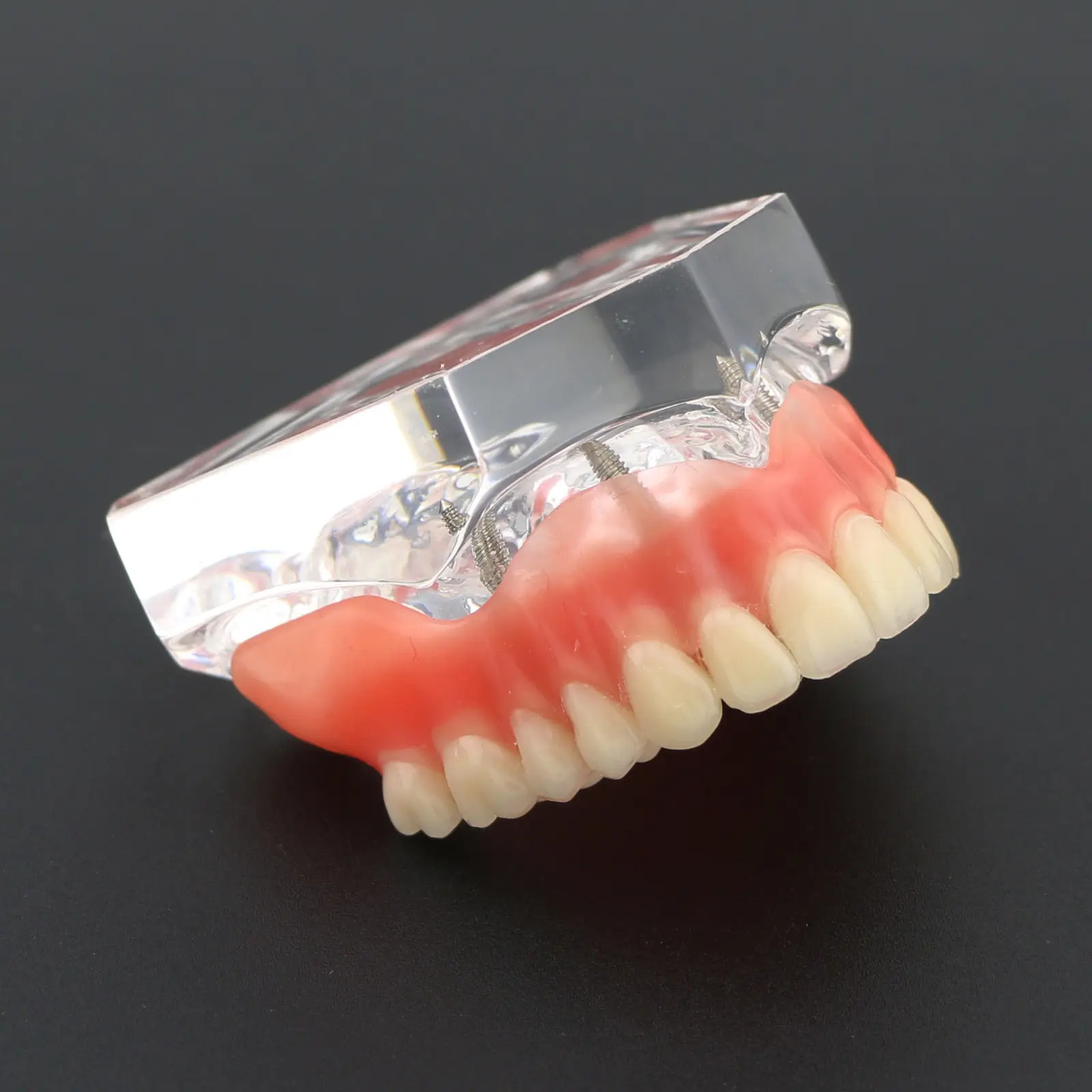 1 шт./упак. Dental Upper Overdenture Superior 4 имплантаты демо модель 6001 02