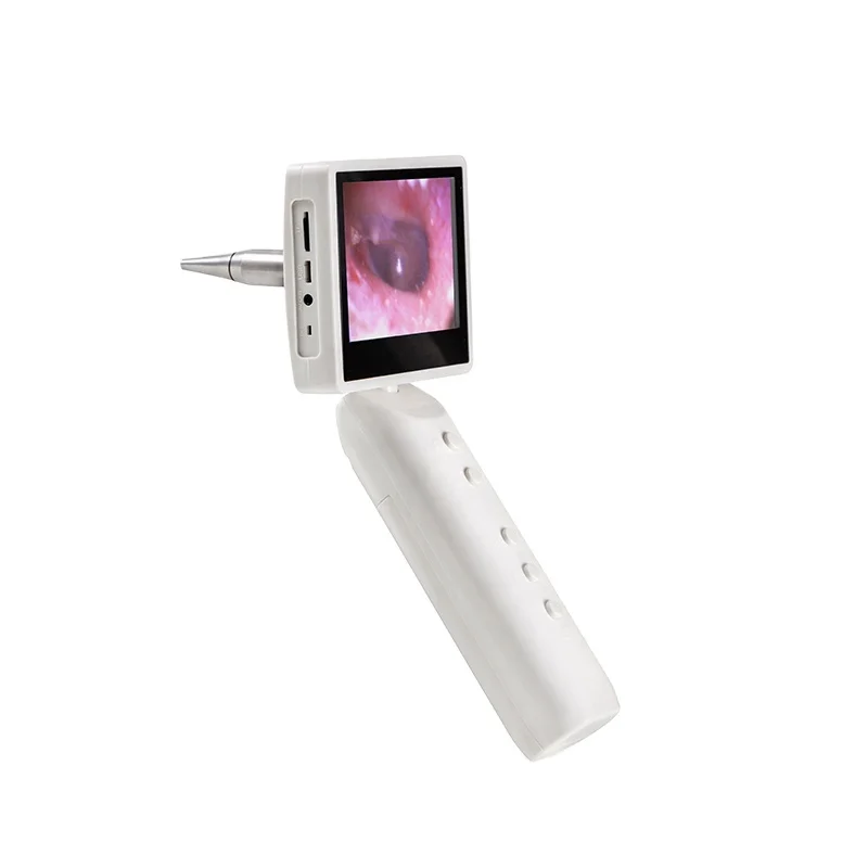 

IN-S1 handheld digital video ear otoscope