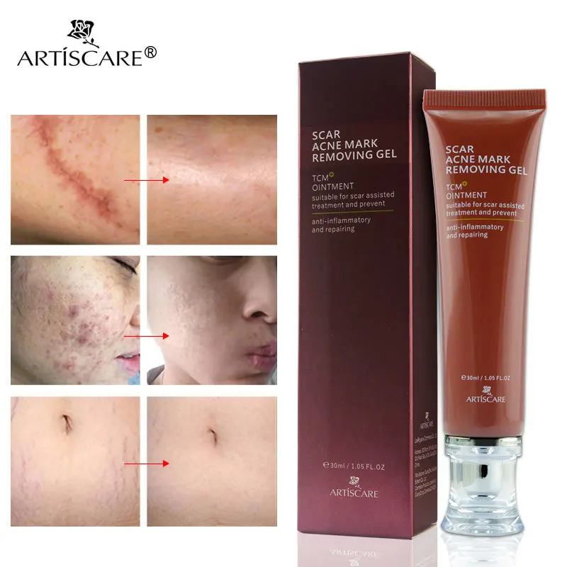 

ARTISCARE Scar Acne Mark Removing Gel TCM Blackhead Treatment Whitening Skin Care Makes Repair Skin Soft Smooth Face Cream