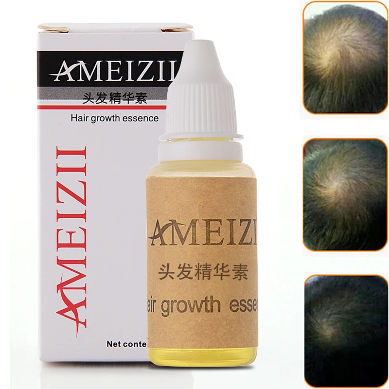

AMEIZII Ginger Hair Growth Anti Hair Loss Liquid 20ml Dense Hair Fast Sunburst Andrea Hair Growth Grow Alopecia