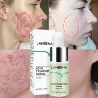 lanbena salicylic acid acne removal serum anti acne repair fade acne spots oil control moisturize inflammation essence skin care