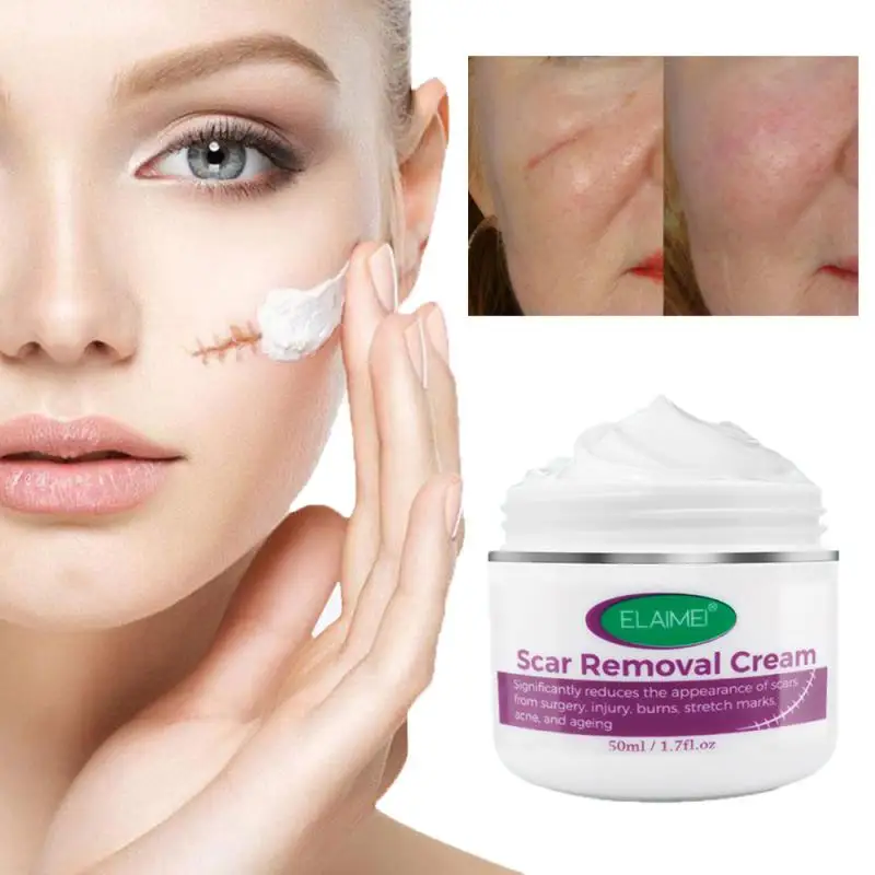 

Removal Scar Cream Face Pimples Scar Stretch Marks Removal Acne Treatment Whitening Moisturizing Cream Skin Care