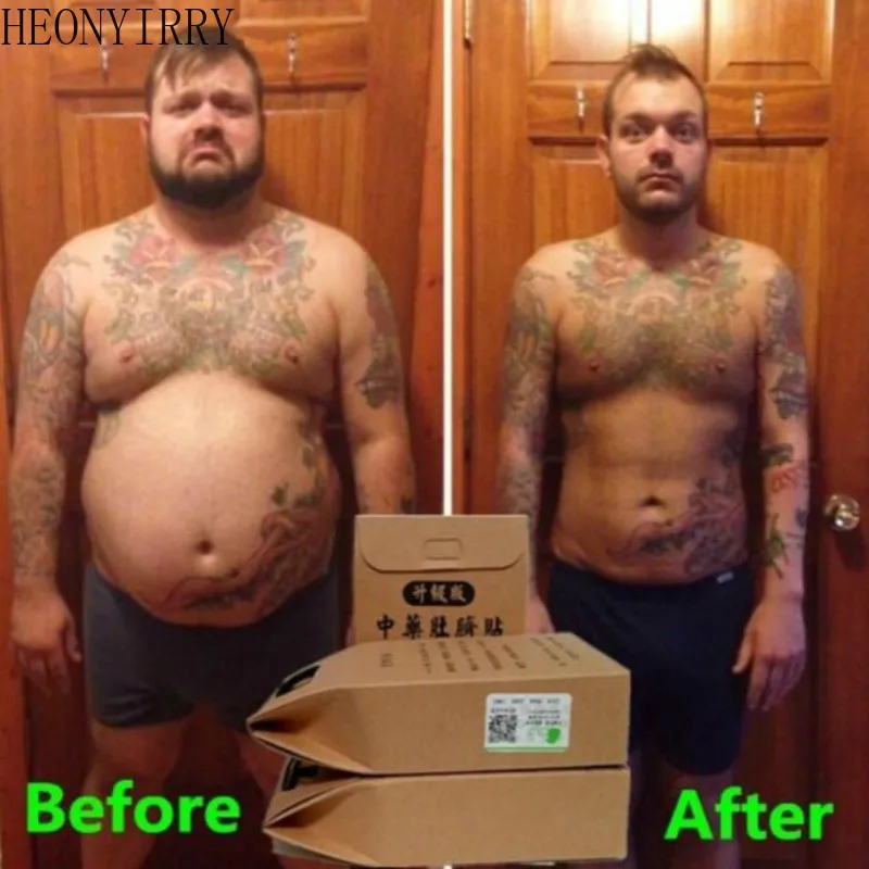 Пластыри китайские для похудения 10/20/30 шт.|Товары похудения| |