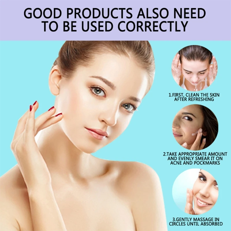 2021New 30g Face Blemish Freckle Cream Pimple Acne Treatment Scar Dark Spots Removal Whitening Moisturizing Skin Repair Ointment