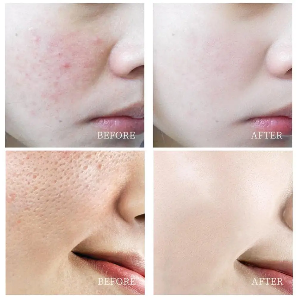 

Green Tea Face Mask Remove Acne Blackhead Nose Deep Supplies Cleaning Skin Beauty Cleansing Pore T8Y6