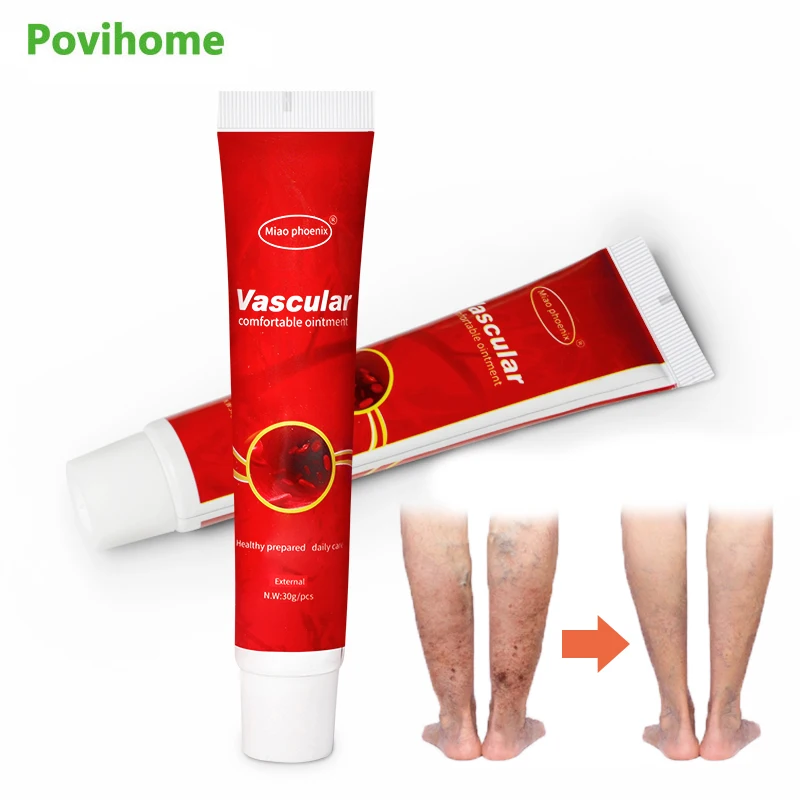 

1pcs 30g Varicose Vein Treatment Ointment Vasculitis Spider Pain Relief Cream Anti-swelling Herbal Extract Medical Plaster