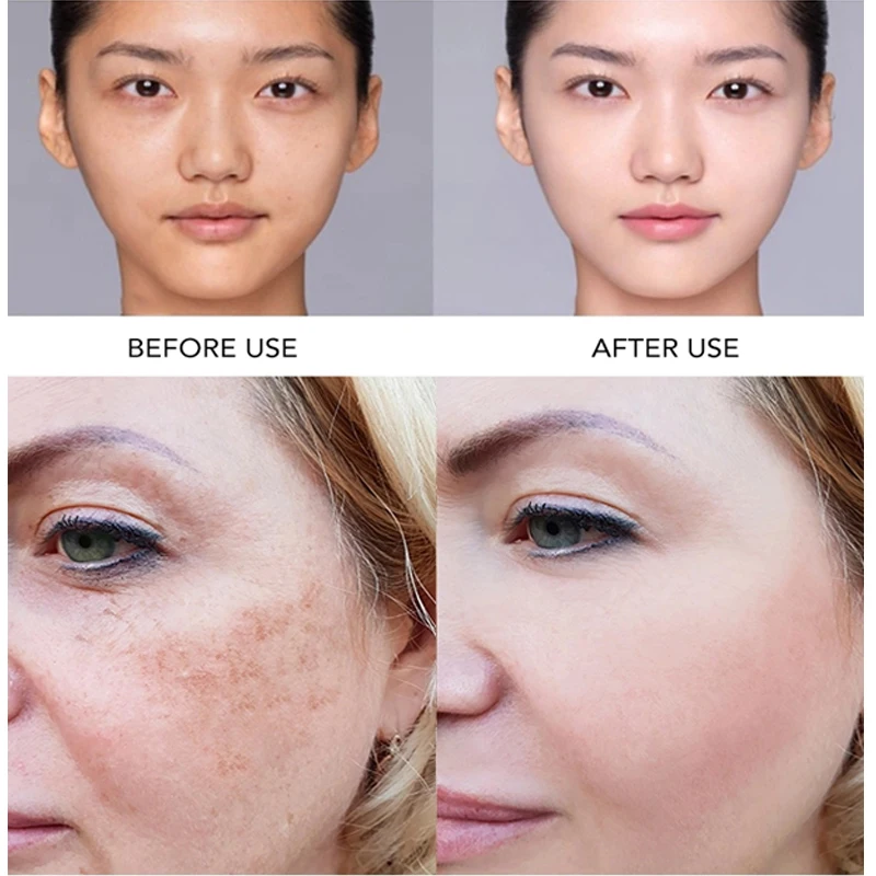 

FEI QUE Organic Red rose oil women facial skin natural Cream Whitening Anti-Freckle Wrinkle female face care Set in Seychelles