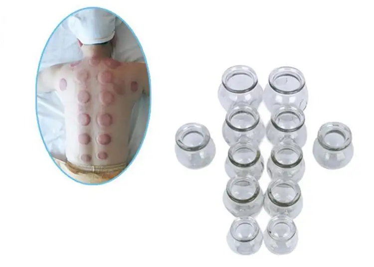 Бесплатная доставка 4 шт. традиционный китайский стеклянный Массажер для терапии