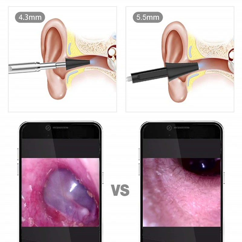 TESLONG 3 в 1 ухо эндоскоп Камера 4 мм инструмент для чистки ушей визуальная ухочистка