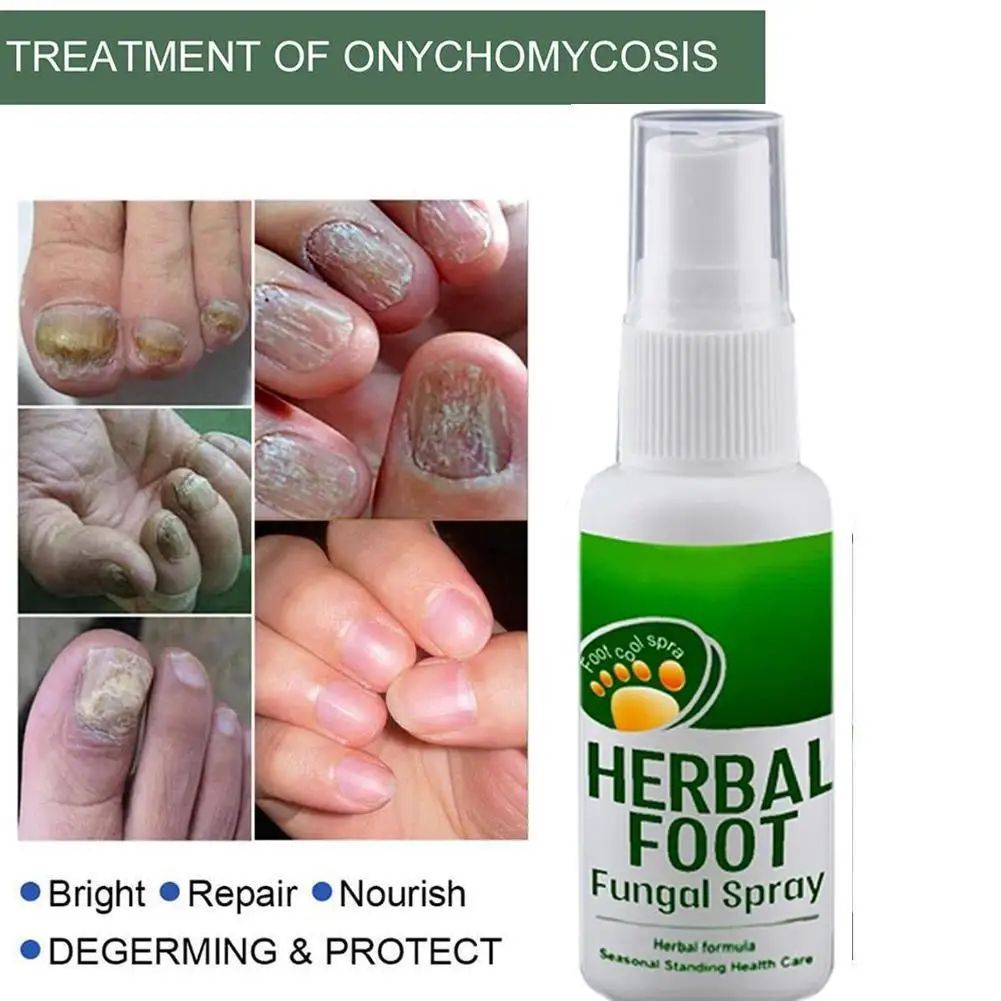

30ml Foot Sterilize Spray Herbal Anti-fungal Infection Toe Treatment Onychomycosis Nail Paronychia Effective Fungus Repair V3M7