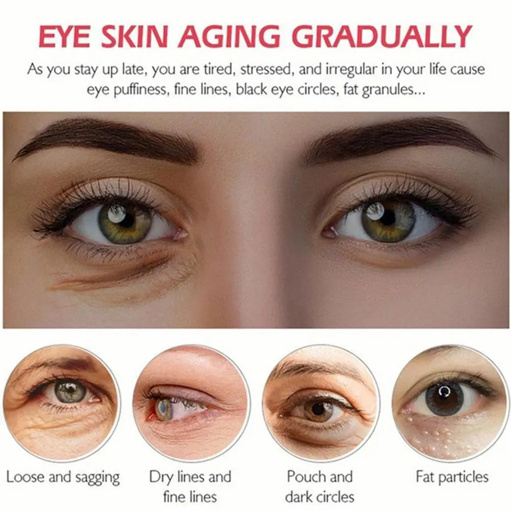 

30 г от жирного блеска для удаления для ухода за областью вокруг глаз, крем для удаления кругов под глазами против линии крем увлажняющий кре...