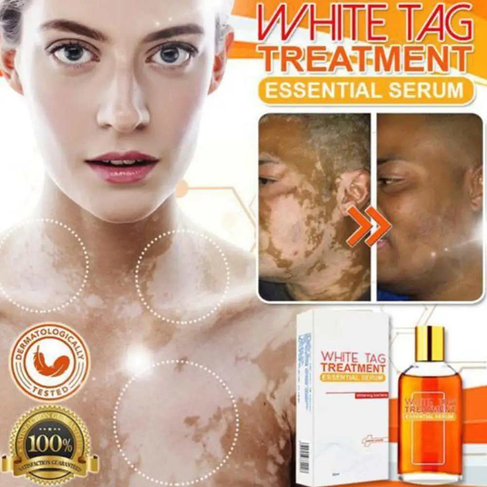

50ml White Spot Repair Essence Remove Skin Toxins Suitable For All Skin Types J5M1