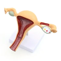 female genital anatomy model uterus ovary genitourinary medical teaching model