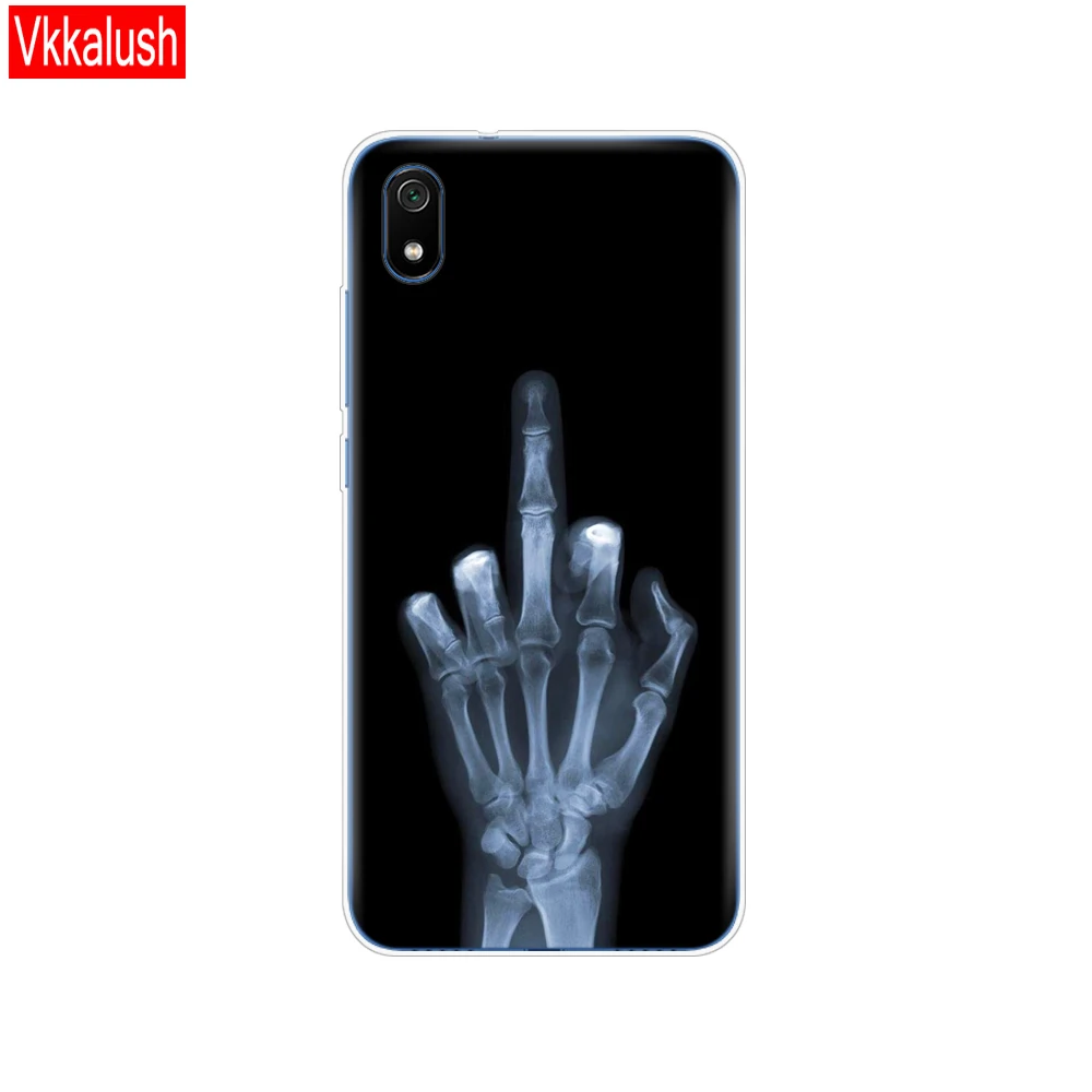 80252 Чехол для Xiaomi redmi 7a чехол s полная защита Мягкий ТПУ силиконовый чехол на заднюю панель для redmi 7 A бампер redmi 7a чехол для телефона с кошкой - Цвет: 80252