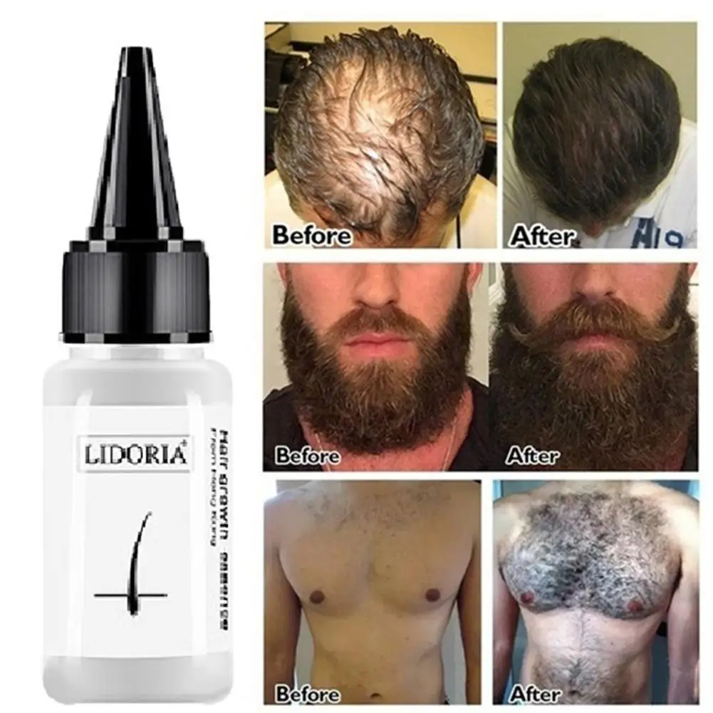 Растительный питательный раствор для роста волос эфирное масло из черных