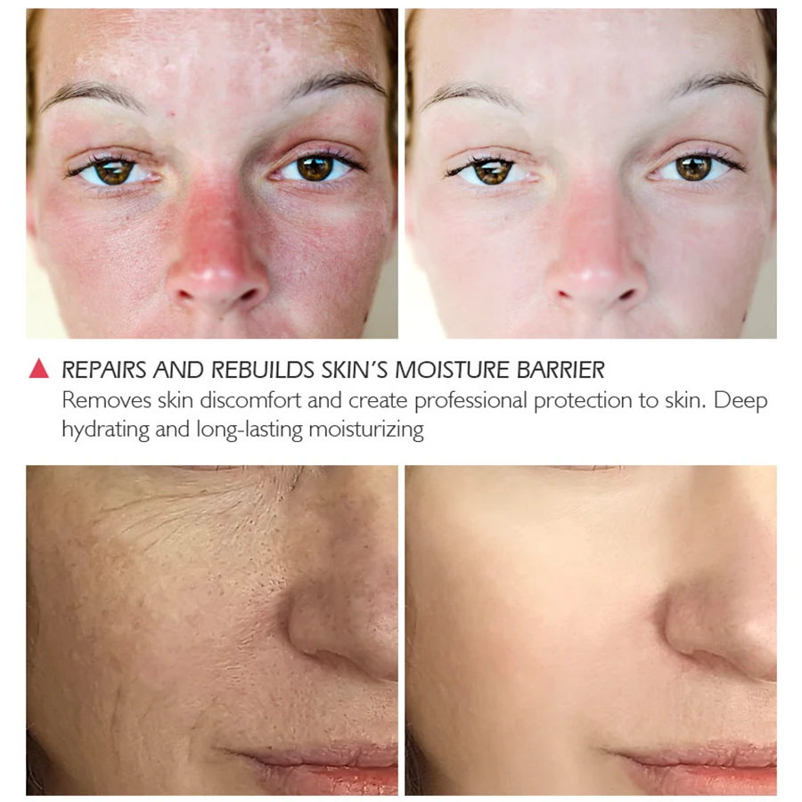 Сыворотка для лица отбеливающая Антивозрастная увлажняющая Антиаллергенная