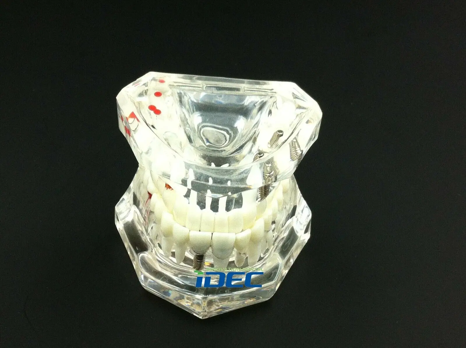

Dental Implant Study Analysis Demonstration Teeth Model 1pc 2001