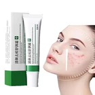 Эффективный крем для удаления акне, лечение акне, увлажнение, отбеливание, уход за кожей