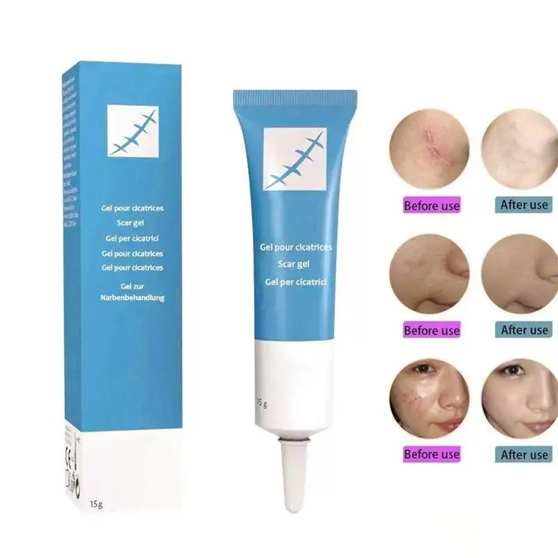 Крем для удаления рубцов 15 г крем прыщей растяжек пятен и пятен|Дневные крема