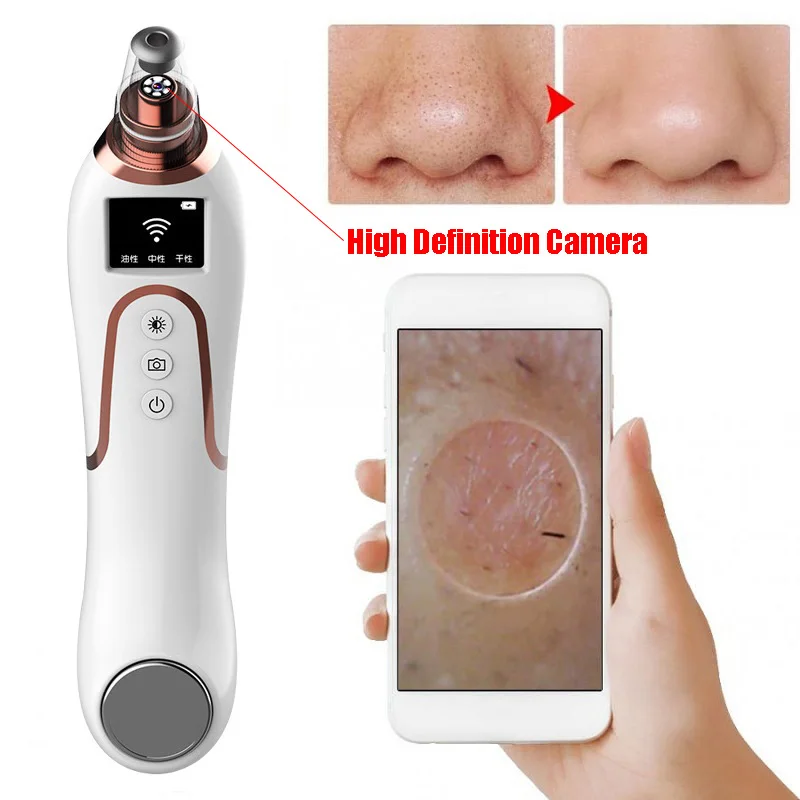 Новое прибытие умный WIFI визуальный Удаление угрей вакуумный очиститель пор