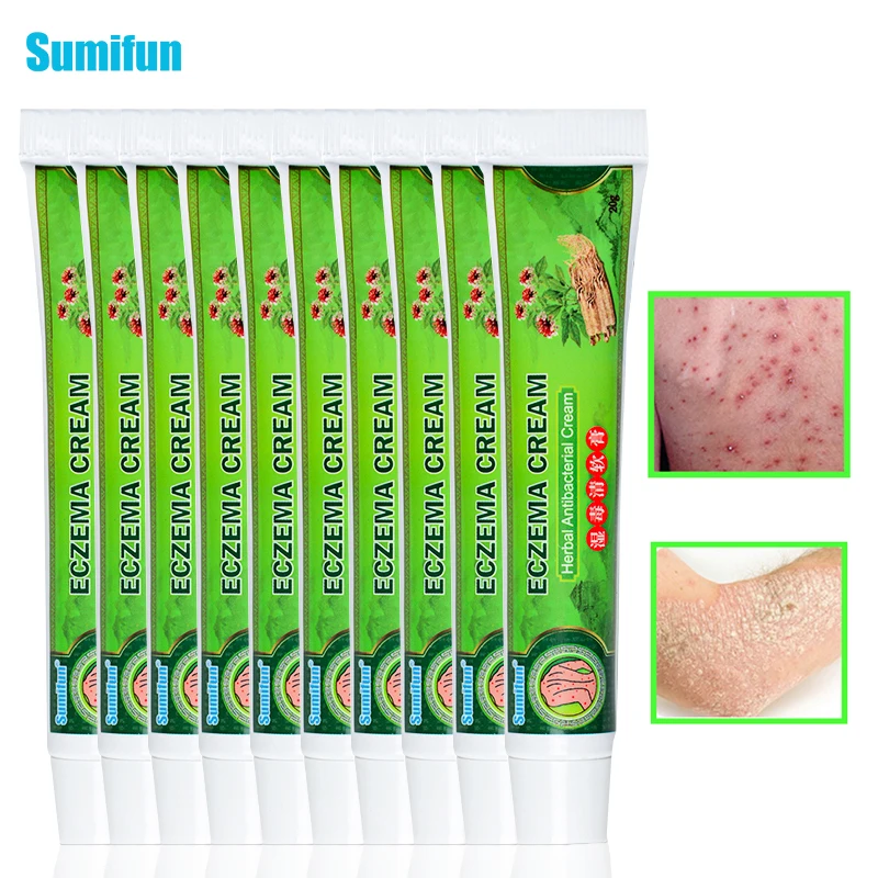 10 шт. антибактериальный крем от экземы и зуда D2616 | Красота здоровье