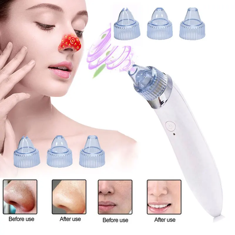 Уход за кожей угрей Удаление прыщей вакуумный всасывающий инструмент аппарат