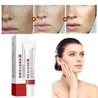 Эффективное лечение акне удаления прыщей уход за кожей крем выцветают масло от акне поры Управление увлажняющий крем пятна восстановление и отбеливание E8E9