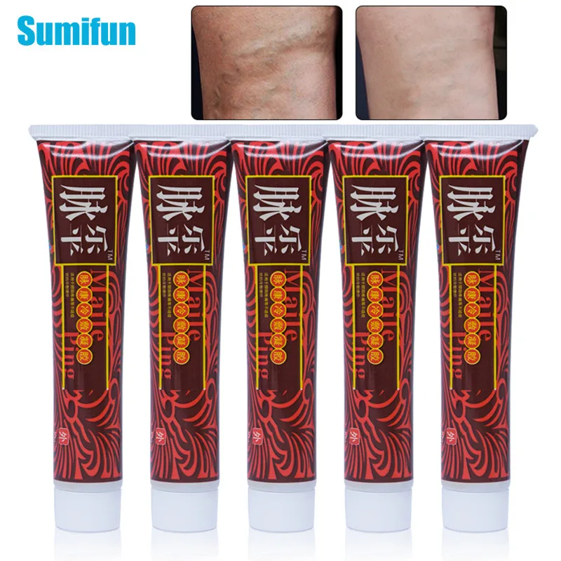 Sumifun 5 шт. мазь для варикозных вен лечение удаление варикозного ангиита