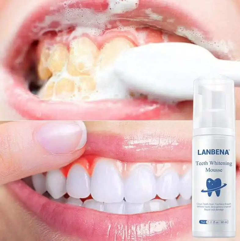 Средство для отбеливания зубов LANBENA гигиеническая зубная паста удаления пятен |