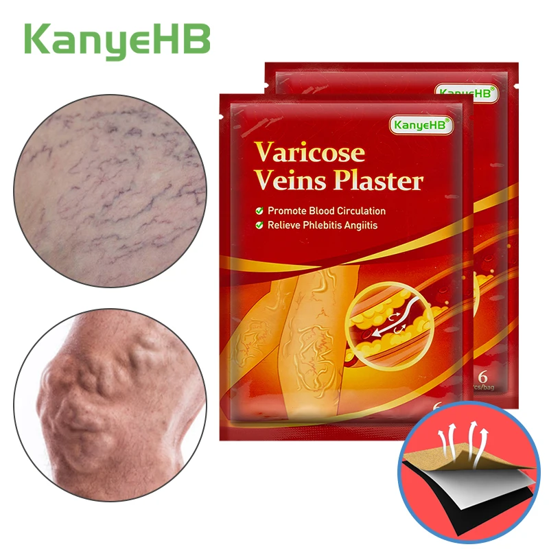 

12 шт./2 упаковки, мощный Пластырь от варикозного расширения вен