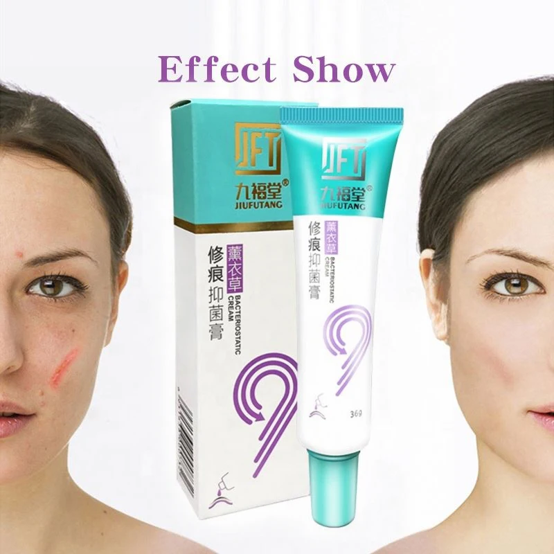 

Scar Removal Cream Acne Scars Gel Stretch Marks Surgical Scar Burn For Body Pigmentation Corrector Acne Spots Repair Care 36g