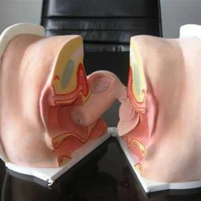 Проектирование семьи Современное женское вагинальное противозачаточное