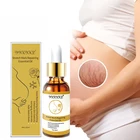 Средство для удаления растяжек, эфирное масло, крем для ухода за кожей, для Удаления растяжек, для беременных