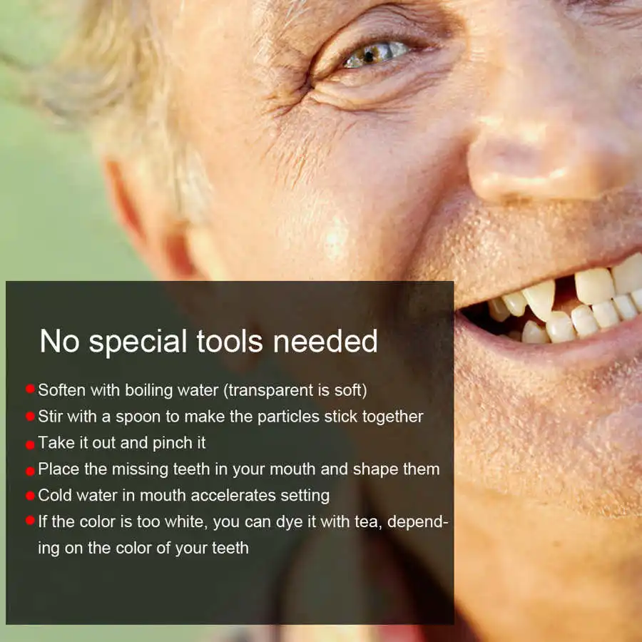 Бусины для временного ремонта зубов отсутствия сломанных материал наполнения