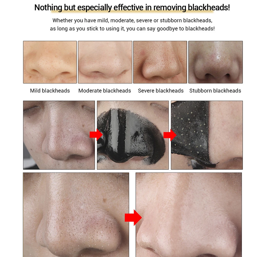 10 шт. пилинг от акне черная маска для носа с контролем масла глубокий инструмент