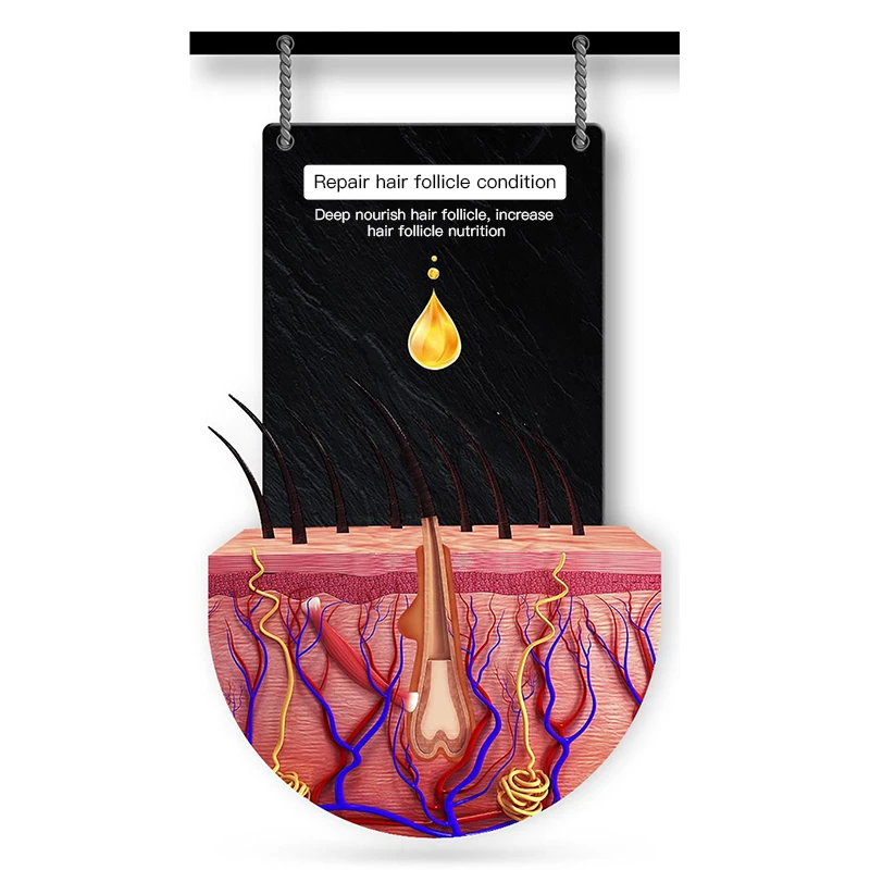 30 мл жидкость для роста волос женщин против выпадения лосьон наращивания мужчин