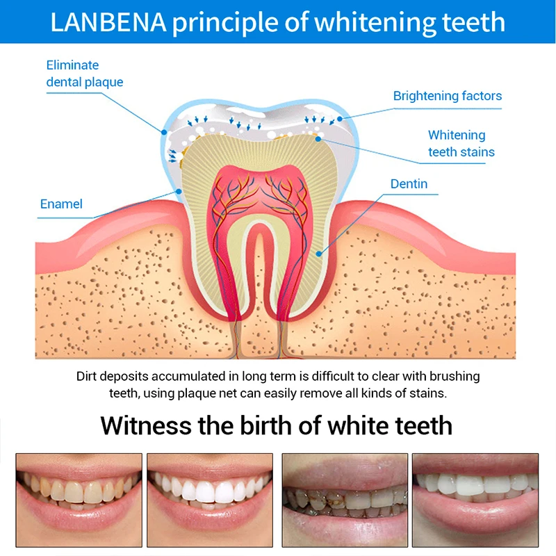 Зубная отбеливающая пудра с эссенцией сыворотка для гигиены полости рта удаляет