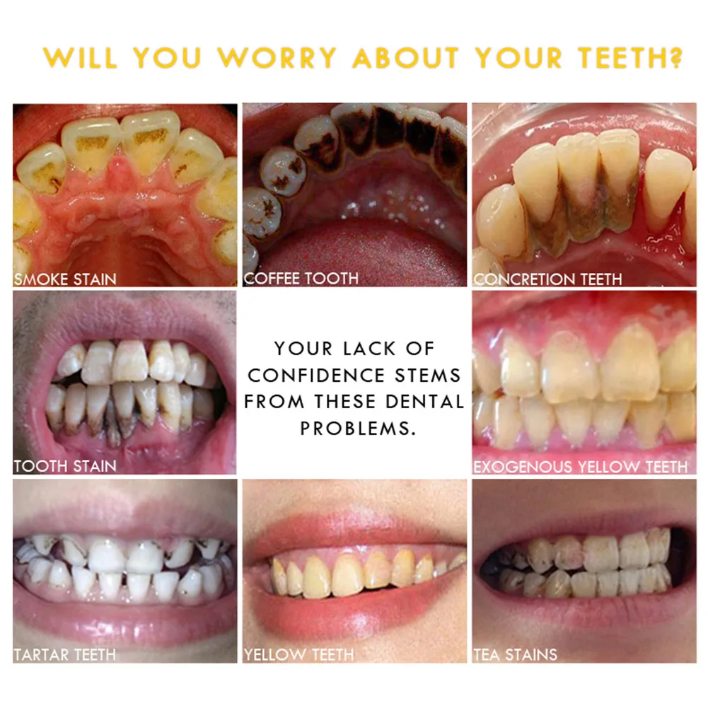 10 мл эссенция жидкость для отбеливания зубов удаление зубного налета сыворотка