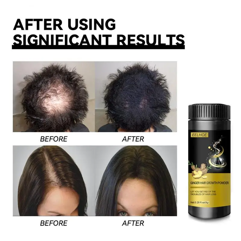 

Natural Ginger Hair Growth Essences Instantly Black Root Hair Fluffy Powder Hair Loss Hairline Repair Hair Fibers Styling Tool