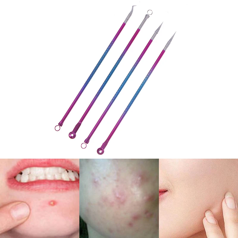 

4 шт., иглы для удаления черных точек, из нержавеющей стали