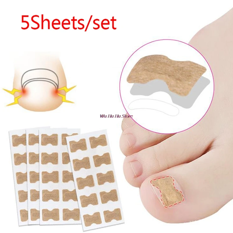 

50Pcs Ingegroeide Teennagel Corrector Stickers Paronychia Behandeling Corrector Pedicure Vingernagel Toe Nail Care Nieuwe