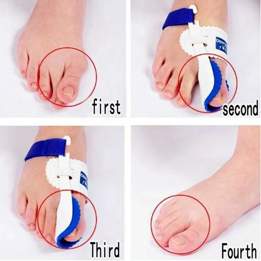 Коррекция большого пальца и вальгусной деформации|Инструмент для ухода за