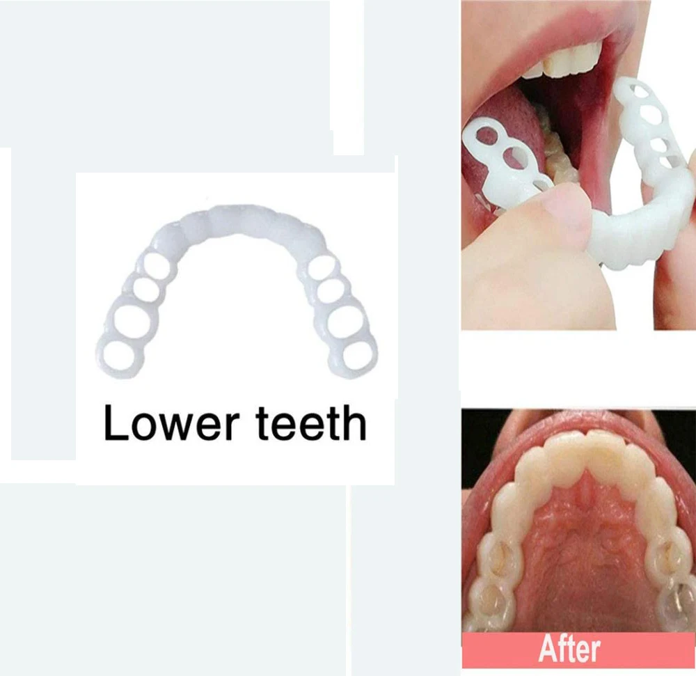 2 шт. силиконовые виниры для отбеливания зубов |