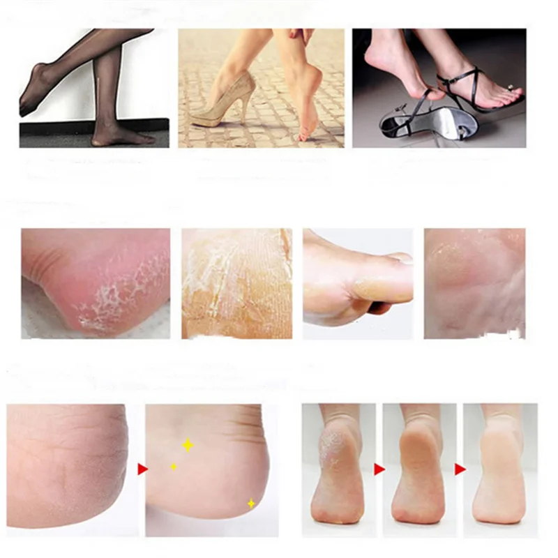 Набор для маникюра и педикюра ногтей 8 шт. рашпили скребок удаления омертвевшей