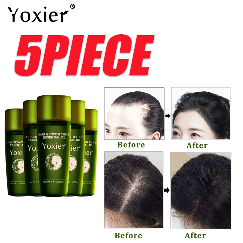 

Yoxier Herbal Hair Growth Essential Oil Hair Loss Treatment Effective Rapid Growth Growth Serum For Men Women Hair Care Product