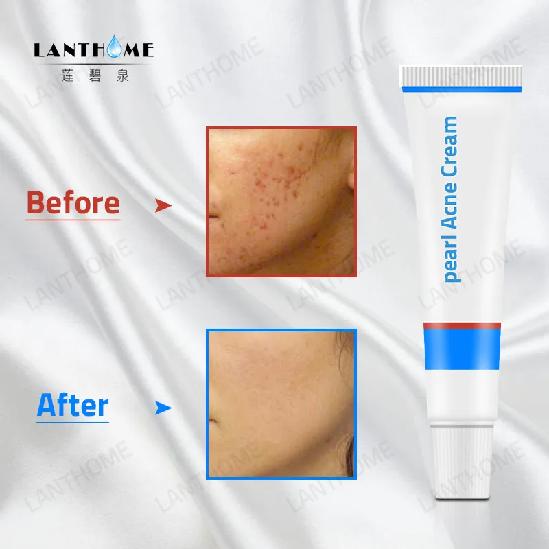 3 шт. отшелушивающая мазь для лица | Красота и здоровье